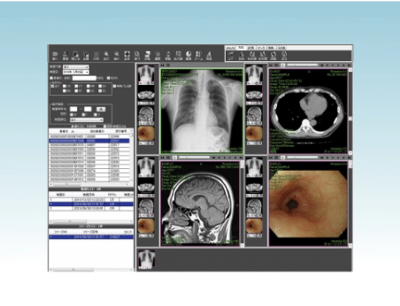 医療用画像管理システム アポロプラスプロ